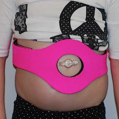 Peg tube belt shop